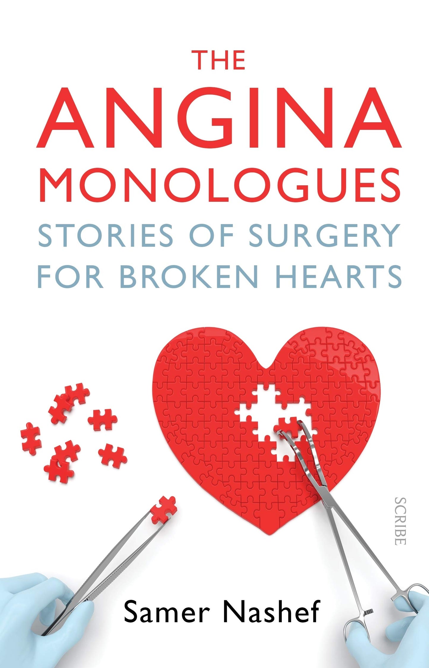 The Angina Monologues: Stories of surgery for broken hearts